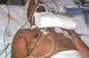 Racist attack victim Shravan out of danger