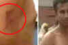 Engineering student brutally ragged in Faridabad