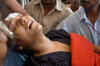 Sportswoman Arunima's condition critical, say doctors